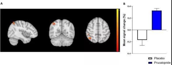 ​牛津科学家发现：通便也能通记忆，这种药物或可促认知作用