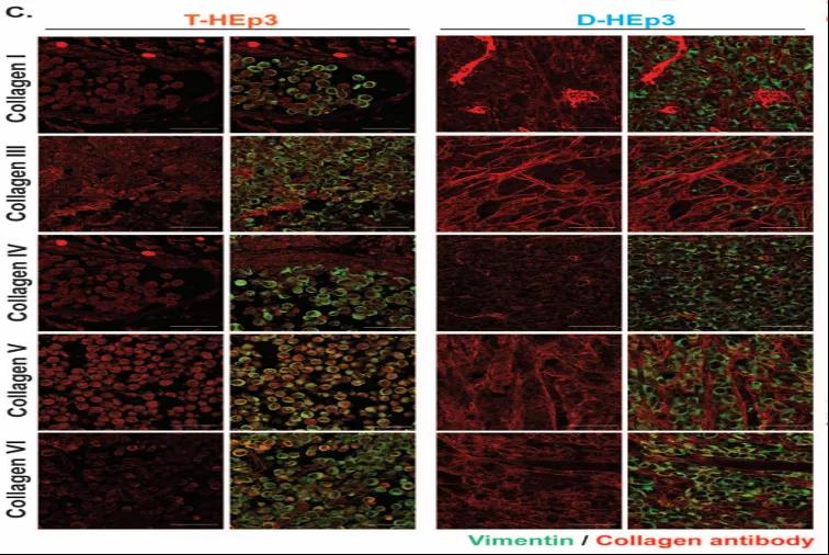 让癌细胞“一睡不醒”！向肿瘤微环境中添加III型胶原蛋白可防止肿瘤复发和转移