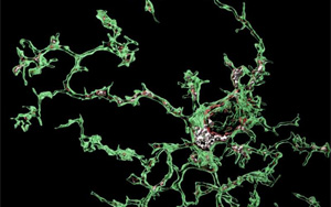 Nature子刊：血管周围细胞诱发阿尔茨海默病相关的微胶质功能障碍