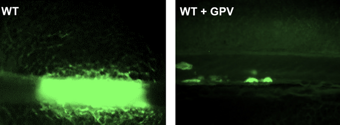 用可溶性GPV治疗可以在实验性小鼠血栓形成模型中防止血管闭塞性血栓的形成