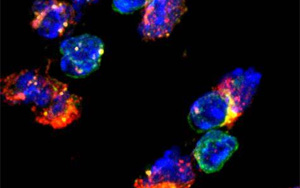 《Nature Immunology》两种不同类型的免疫细胞帮助20亿人控制结核病