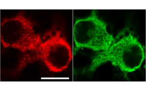 《PNAS》从过度反应蛋白合成到认知障碍，敲除1个基因即可