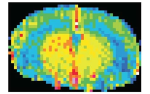 Nature Neuroscience：一种免疫蛋白可能诱发与高血压无关的痴呆