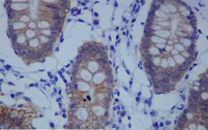 《PNAS》一种不为人知的蛋白质，它能保持人体细胞的健康