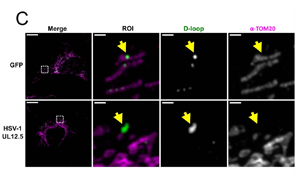 Nature子刊：细胞中的线粒体“泄漏”了，是如何让我们生病的