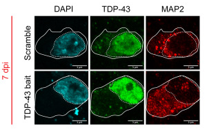 Cell Stem Cell：利用类器官保护痴呆和ALS中受到的脑损伤